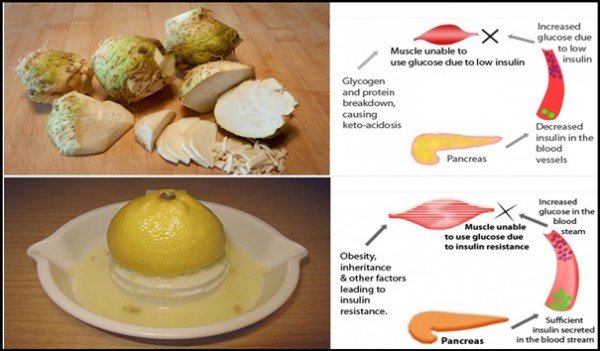 receptek cukorbetegség kezelésére citrom
