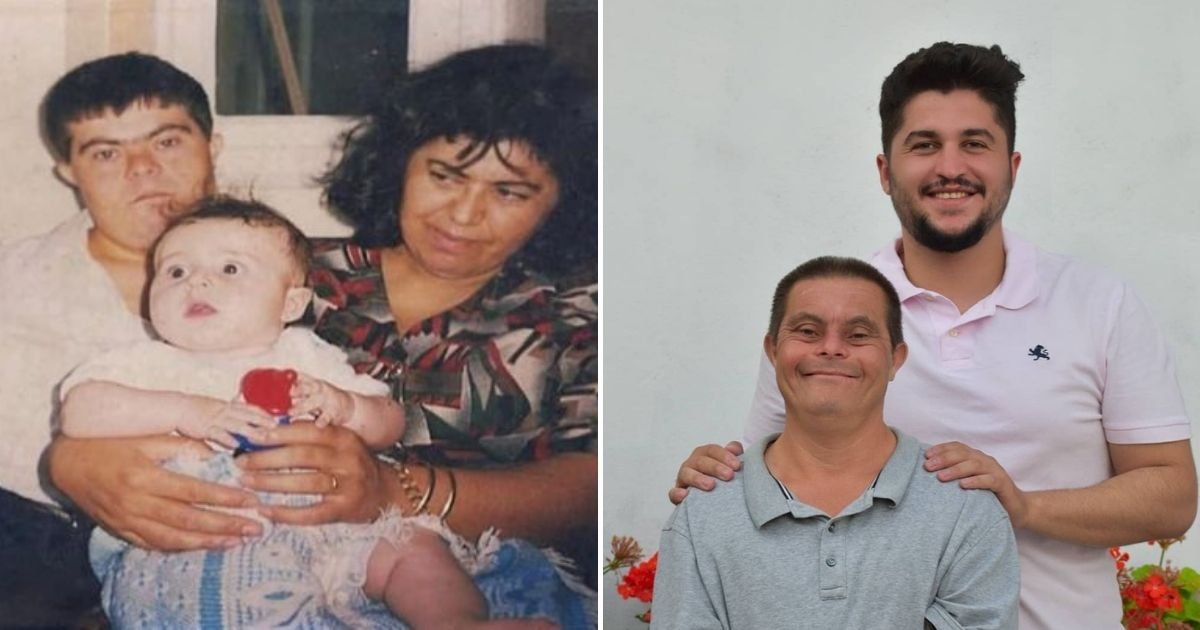 “Egy Down-szindrómás apa nevelt fel” - büszkén vállalja édesapját a fogorvos végzettségű férfi