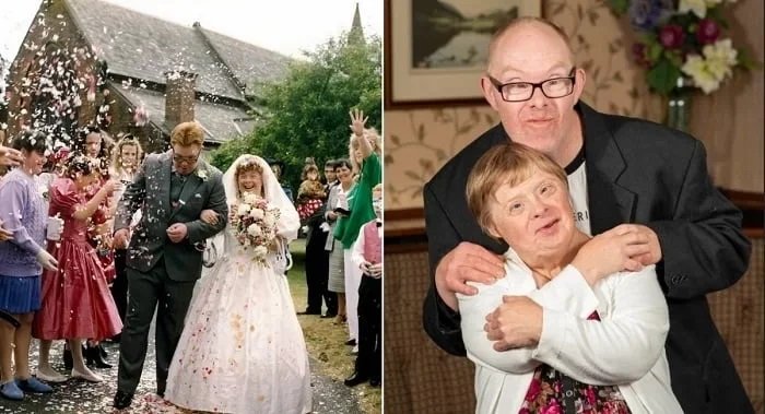 A világ első Down-szindrómás házaspárja 28 éve kelt egybe - még mindig ugyanúgy szeretik egymást